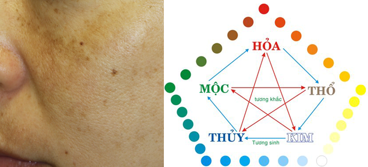 Có hay không mối liên quan giữa nám da và phong thủy?
