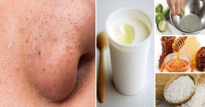 Trị mụn đầu đen trong nháy mắt với 3 mặt nạ tự chế tại nhà