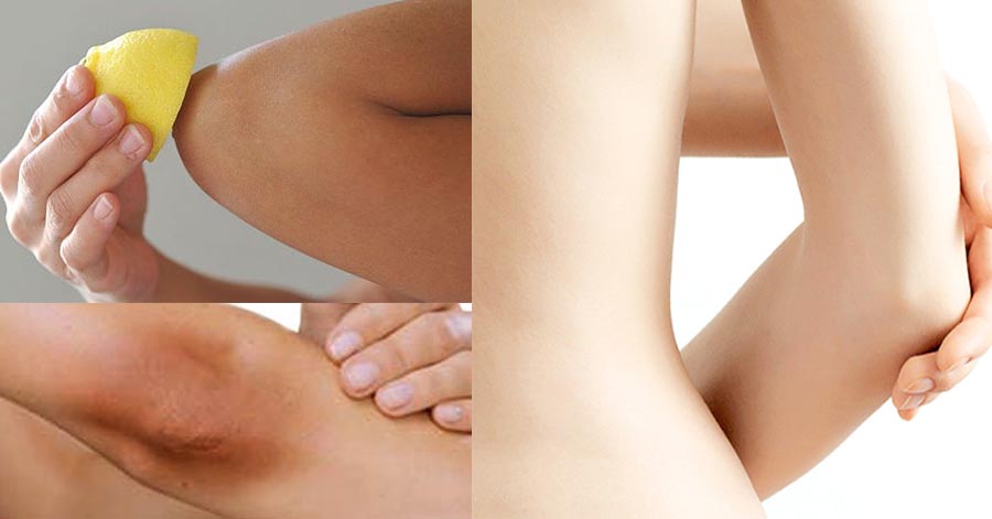 13 mẹo đơn giản giúp khuỷu tay mịn màng, trắng đều