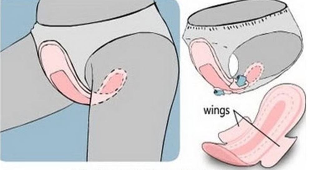 Thói quen chết người khi dùng băng vệ sinh khiến nhiều phụ nữ mắc bệnh phụ khoa