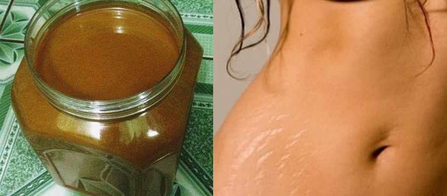 Bị chồng chê xấu, tôi đã lột xác chỉ trong 1 tháng nhờ cách này