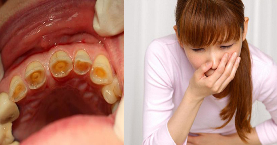 Hãy dừng ngay việc uống nước chanh giảm cân thế này, nguy hiểm không lường trước được không phải ai cũng biết