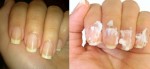 6 cách làm trắng móng tay vàng ố bằng nguyên liệu đơn giản tại nhà