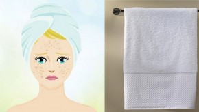 5 nguyên nhân gây ra mụn bạn sẽ không bao giờ nghĩ tới