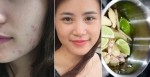 Chuẩn bị sả + chanh + gừng xông hơi 2 lần/tuần, mụn hết sạch, da còn trắng hồng chẳng cần thoa kem