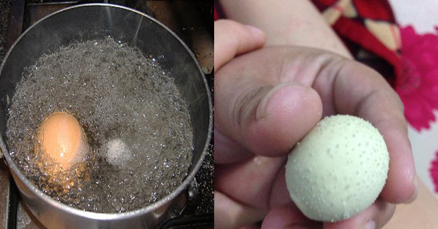 Hút sạch nhân mụn đầu đen chi chít ở mũi và 2 bên cánh mũi nhờ quả trứng luộc