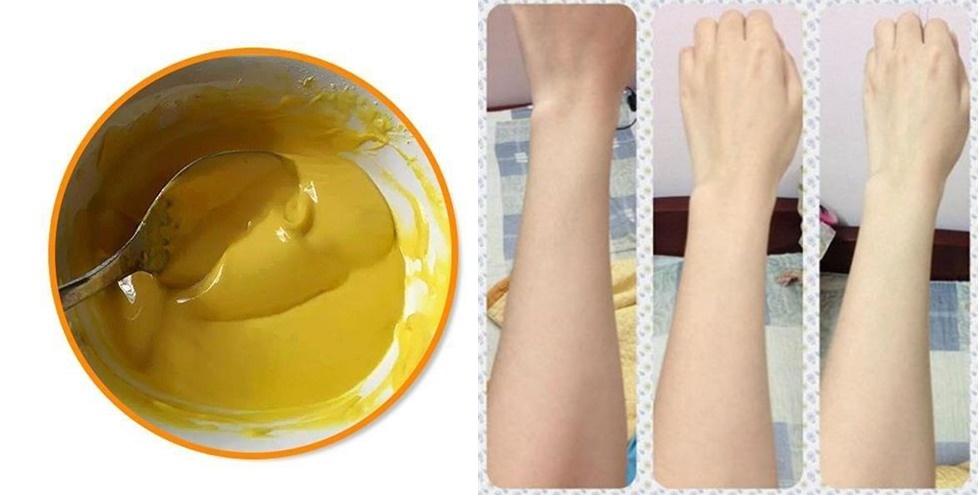 Da trắng bật tone nhanh chóng nhờ công thức đơn giản với tinh bột nghệ
