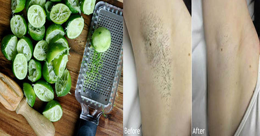 Nách thâm đen hay có mùi đến đâu cũng phải khỏi ngay tức khắc chỉ bằng 1 quả chanh