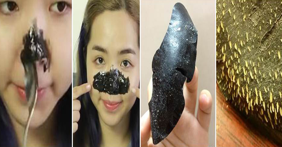 Miếng lột mụn đầu đen được chị em chia sẻ nhiều nhất trên mạng xã hội hiện nay
