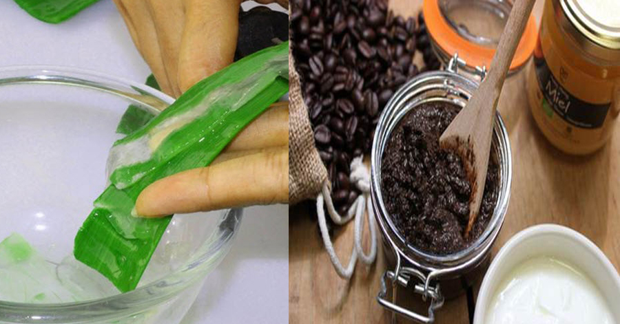 4 mẹo trị sẹo thâm đơn giản được chia sẻ rất nhiều