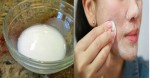 Hòa thứ bột trắng này với nước rồi bôi lên mặt, da hết mụn và thâm sẹo nhanh chóng