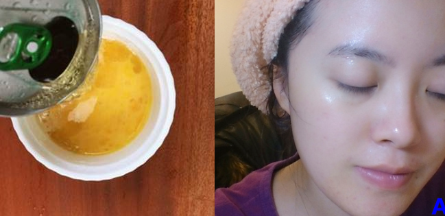 Trộn bia với trứng gà đắp 5 ngày liên tục, bạn sẽ không nhận ra chính mình vì làn da quá trắng lại chẳng nhìn thấy lỗ chân lông