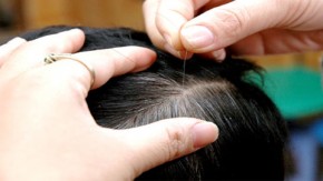 Đây là 4 bài thuốc chữa tóc bạc sớm đặc biệt hiệu quả 10 người dùng 8 người khỏi