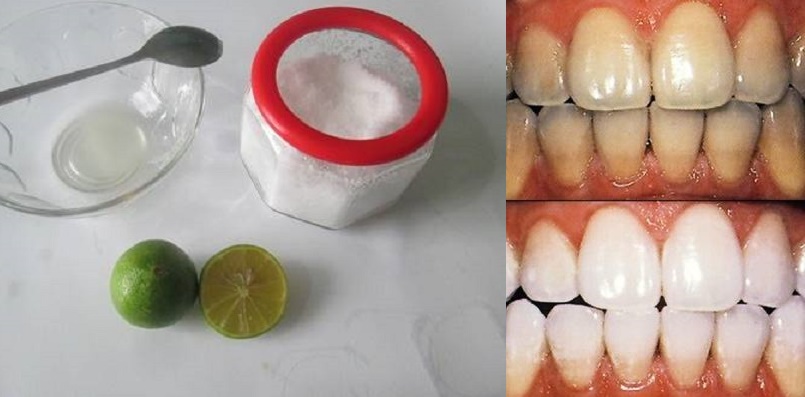 Dùng muối theo cách này, chỉ sau 3 phút dù có hôi miệng hay răng ố vàng lâu năm cũng sẽ biến mất ngay tức khắc