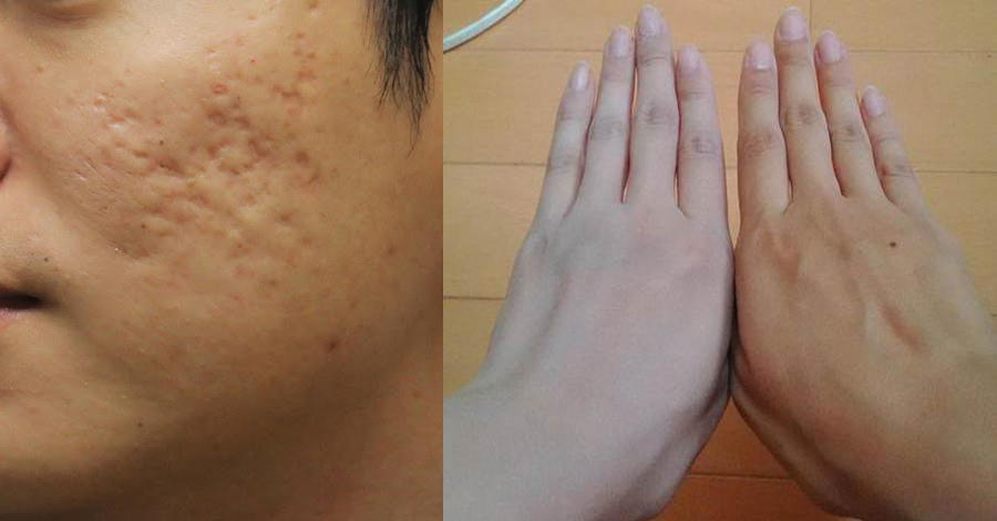 Với 1 quả chanh, bạn có thể chế cả tá mỹ phẩm vừa tốt lại an toàn còn hơn cả hàng cao cấp