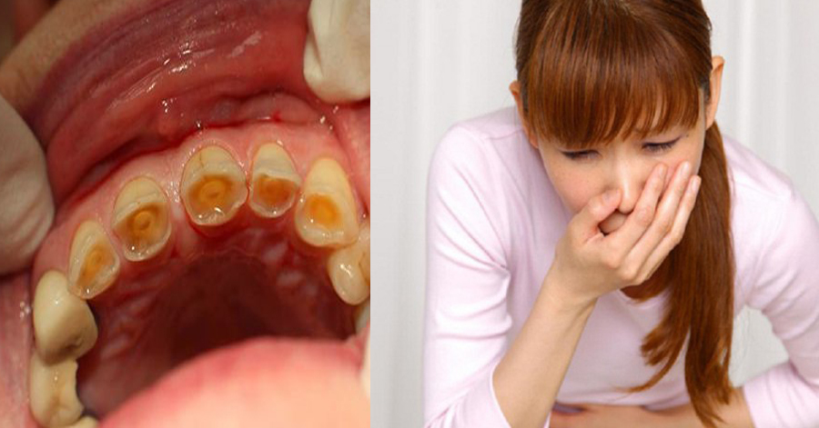 Hãy dừng ngay việc uống nước chanh giảm cân kiểu này, nguy hiểm không lường ảnh hưởng đến bạn