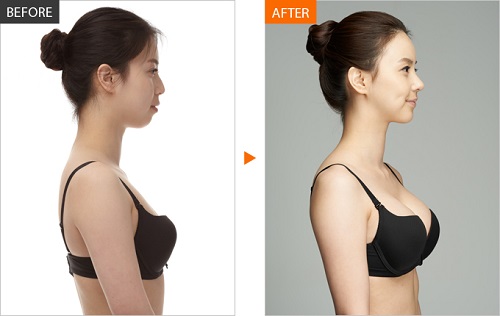 Tạm biệt vòng 1 lép xẹp nếu bạn uống ly nước này trong vòng 2 ngày, hiệu quả khó tin đấy