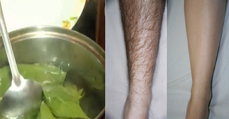 Vò nát lá trầu không rồi đem đun, lông nách, tay và chân tự rụng hết