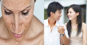 NÁM DA- thủ phạm giết chết hôn nhân, đẩy cuộc sống của vô vàn người phụ nữ vào bế tắc