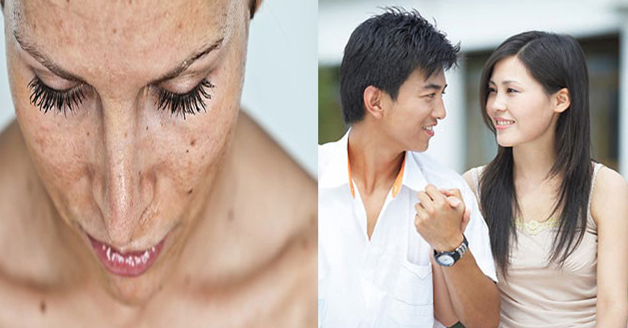 NÁM DA- thủ phạm giết chết hôn nhân, đẩy cuộc sống của vô vàn người phụ nữ vào bế tắc
