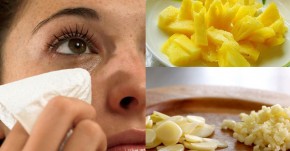1 lát dứa và 1 nhánh tỏi có thể loại bỏ nốt ruồi