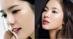 Cuộc sống sẽ sung túc, tiền xài mỏi tay nếu bạn có 5 nốt ruồi tài lộc này trên khuôn mặt