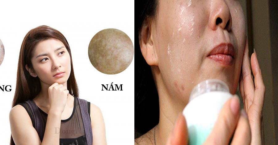 Loại bỏ những thói quen khiến tình trạng nám da ngày càng trở nên tồi tệ