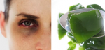 Thâm quẩng ở mắt biến mất chỉ sau 1 đêm nhờ đắp thạch trà xanh