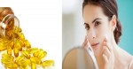 Đánh bay thâm mụn chỉ với 1 viên vitamin E tuyệt diệu này
