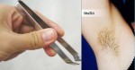 Bạn sẽ từ bỏ ngay thói quen nhổ lông nách bằng nhíp sau khi đọc bài viết này