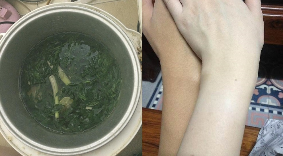 Đun sôi loại lá này rồi tắm, lông nhiều đến đâu cũng rụng sạch không còn 1 cọng, khỏi cả viêm lỗ chân lông