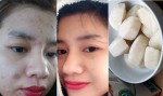 Xông hơi rồi chà đá sữa tươi lên, mặt không còn 1 vết thâm, da trắng hồng chỉ sau 15 phút thực hiện