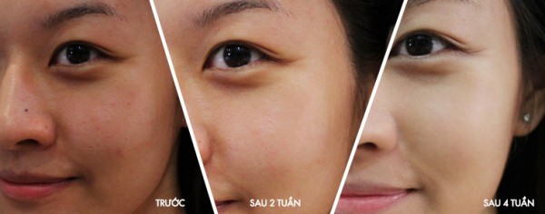 Top 3 loại mặt nạ cứ đắp vào buổi tối là sáng hôm sau da trắng hẳn lại còn trẻ ra cả 10 tuổi