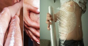 Thoa trứng gà – mật ong quanh bụng rồi quấn nilon, điều kì diệu sẽ xảy ra vào sáng hôm sau