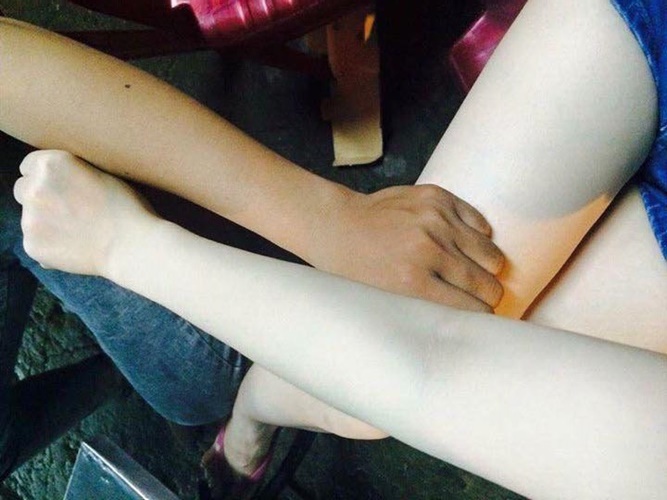 Chẳng cần kem trộn, cứ lấy 1 hộp sữa chua trộn với nước cốt chanh, da sẽ trắng nõn như sứ chỉ sau 1 tuần