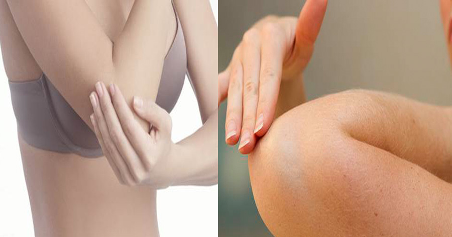 Học cách loại bỏ khuỷu tay thâm xì chỉ trong tích tắc để tự tin diện váy đẹp áo xinh