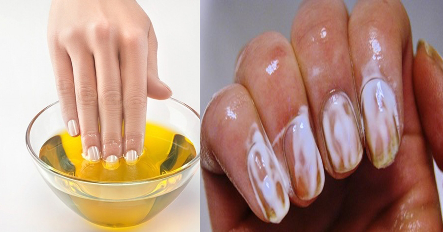Các bước chữa móng ố vàng nhanh chóng trong 1 tuần