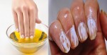 Các bước chữa móng ố vàng nhanh chóng trong 1 tuần
