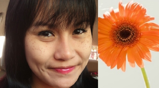 Phái đẹp Việt PHÁT SỐT khi được SOI DA trực tuyến - TƯ VẤN liệu trình điều trị NÁM DA CHUẨN 99‰