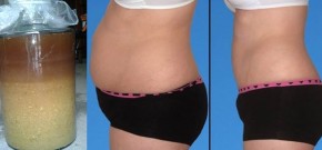 Chỉ cần xoa 2 thứ này lên bụng, mỡ bụng tan chảy như nước, cân nặng giảm “không phanh” chỉ sau 1 tuần