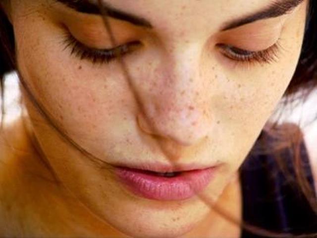 Những biện pháp tự nhiên giúp đẩy lùi đổi mồi hiệu quả