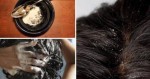 Sau 1 tuần, gàu trắng đầu cũng biến mất không dấu vết nhờ gội đầu với những nguyên liệu rẻ tiền này