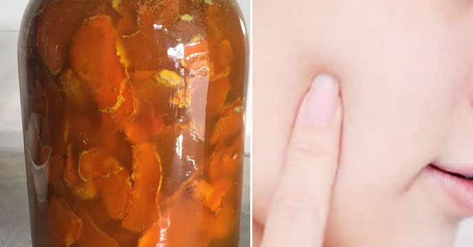5 giọt mỗi ngày, sau 2 tuần TÔI ĐẸP ĐẾN MỨC CHỒNG KÈ KÈ LO MẤT
