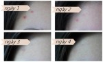 Nguyên liệu thần thánh giúp đánh bay mụn dễ dàng chỉ trong 4 ngày