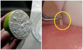 Tuyệt chiêu hô biến mụn ẩn cũng tự trồi lên, dùng nhíp nhổ ra dễ ợt cho mặt căng mịn, láng o như em bé