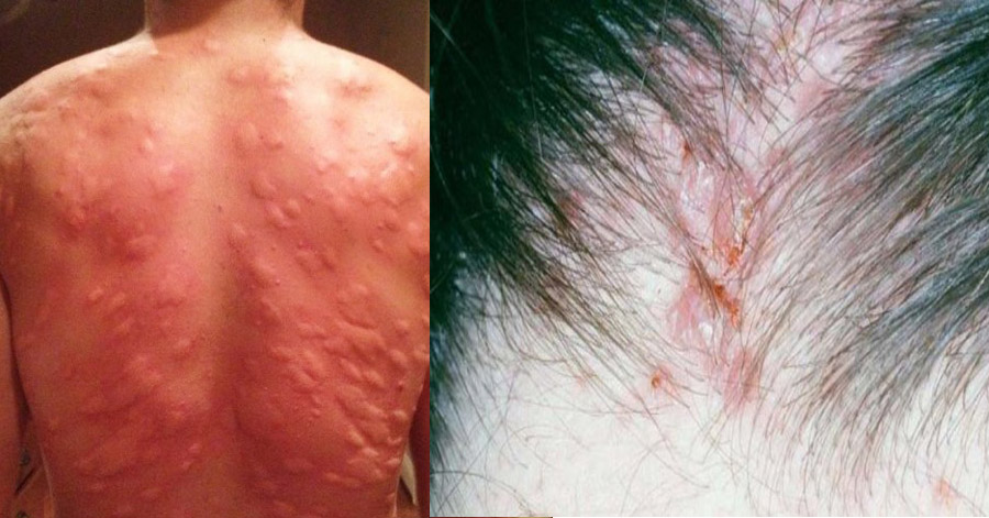 Nguy hiểm khôn lường nếu bạn tiếp tục cắt, cắn, nhổ những chỗ này trên cơ thể