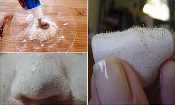 Loại sạch mụn đầu đen với thành phần dễ kiếm tại nhà