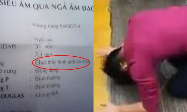 Vợ có thai, đi siêu âm đều đặn nhưng 1 lần chồng mở ngăn kéo thì sửng sốt: "Siêu âm không thấy thai nhi"