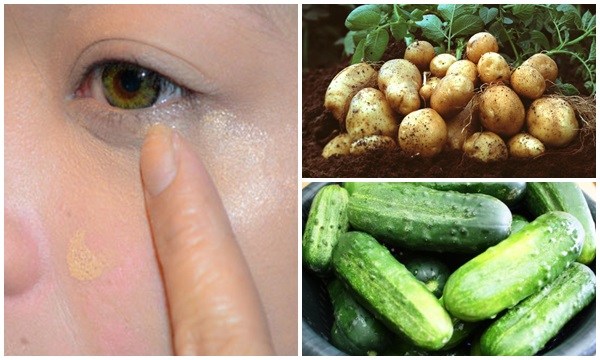 4 cách đánh bay bọng mắt nhanh, gọn, dễ, lại siêu tiết kiệm
