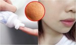 Thoa kem đánh răng lên da, lỗ chân lông se khít khìn khịt vào sáng hôm sau